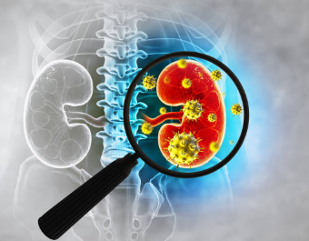 maladie rénale 2